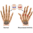 LUVA MAGNÉTICA - ARTRITE, TENDINITE, REUMATISMO, TÚNEL DE CARPO, L.E.R - 1 PAR - Loja Compra Incrível
